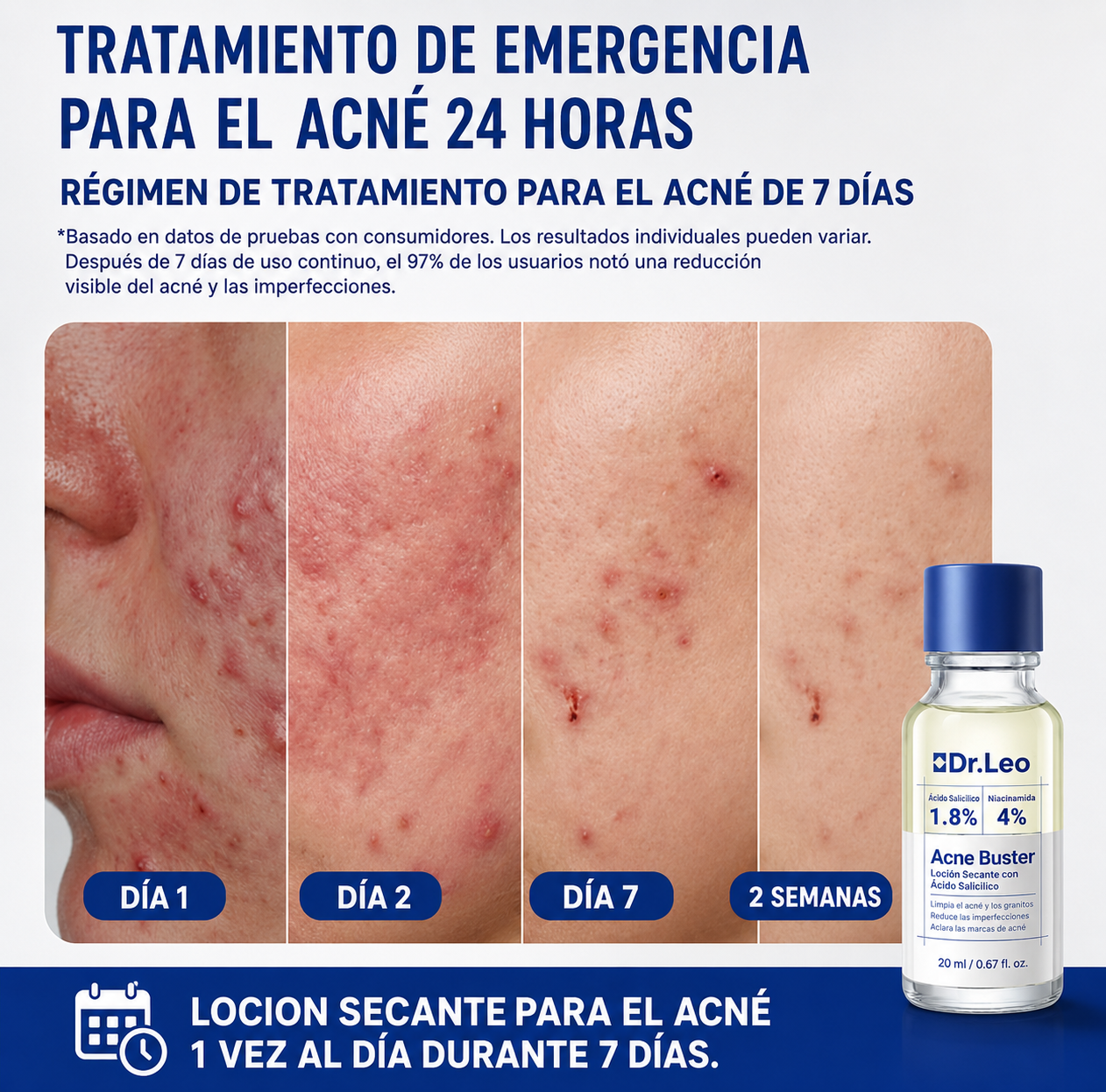 Loción Anti-Acne Seca los granos visibles