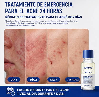 Loción Anti-Acne Seca los granos visibles
