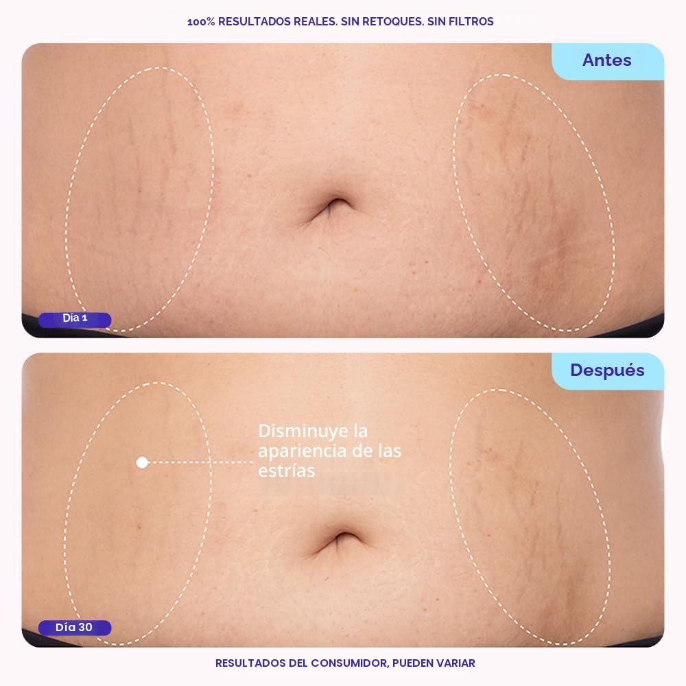 SkinTight™ — Fórmula hidratante para una piel visiblemente más lisa, suave y firme.