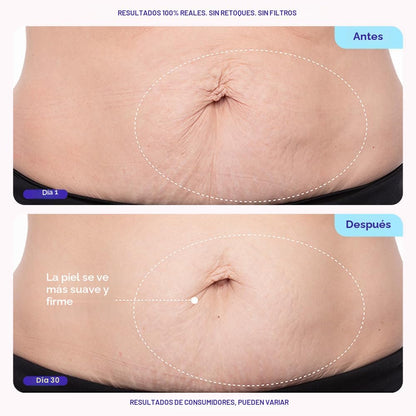 SkinTight™ — Fórmula hidratante para una piel visiblemente más lisa, suave y firme.